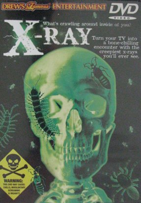 X-Ray